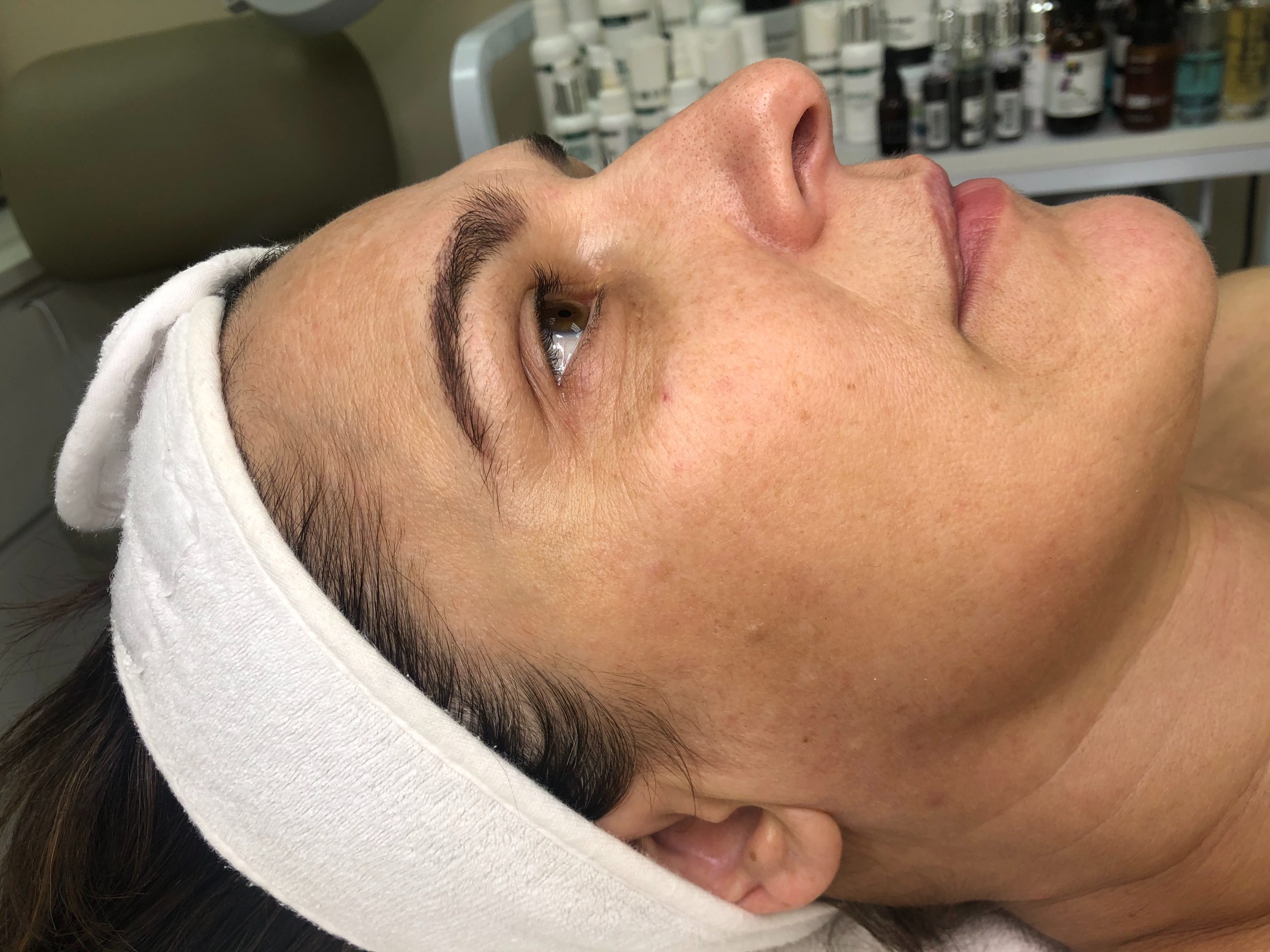 skin care clinic belmont