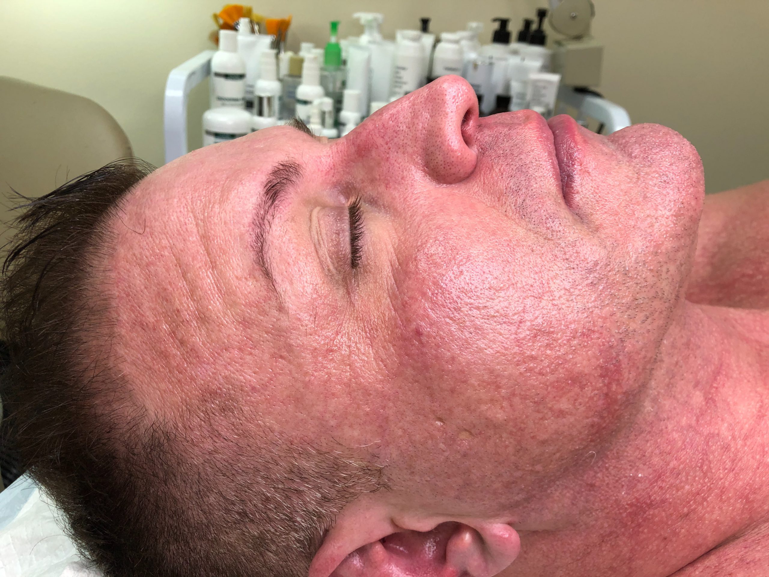 skin care clinic belmont