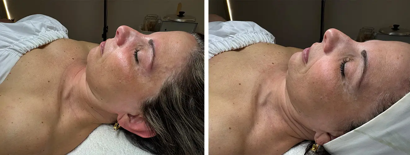 before & after