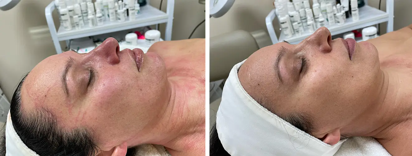 before & after