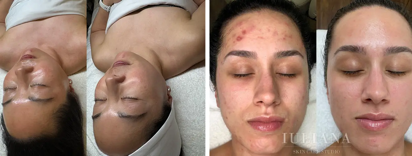before & after