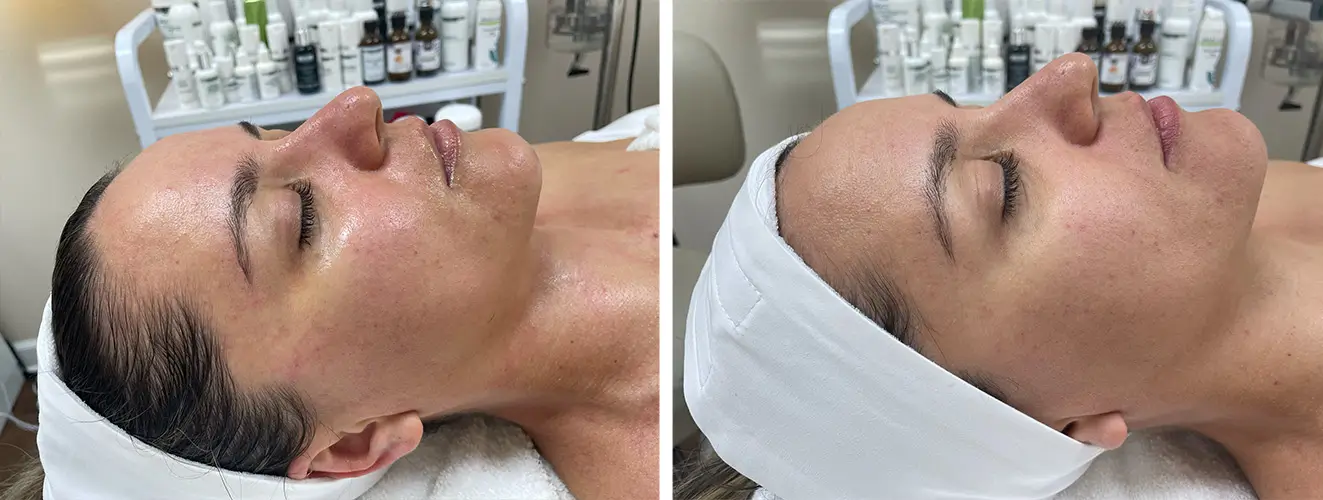 before & after